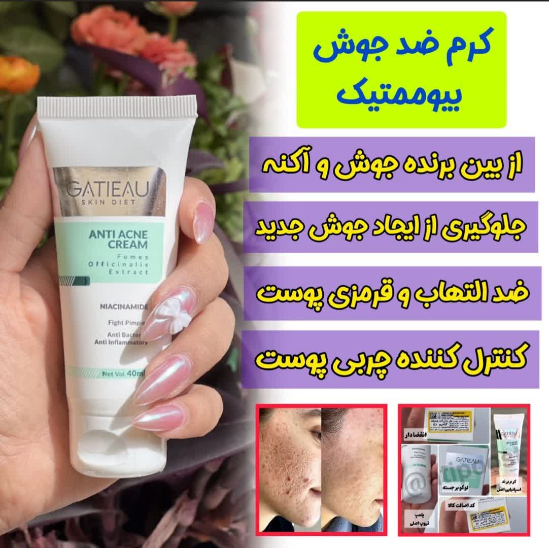 رفع لک و اکنه و جوش با دو محصول ژل انتی اکنه گاتیو و ژل شست و شو ویتابلا