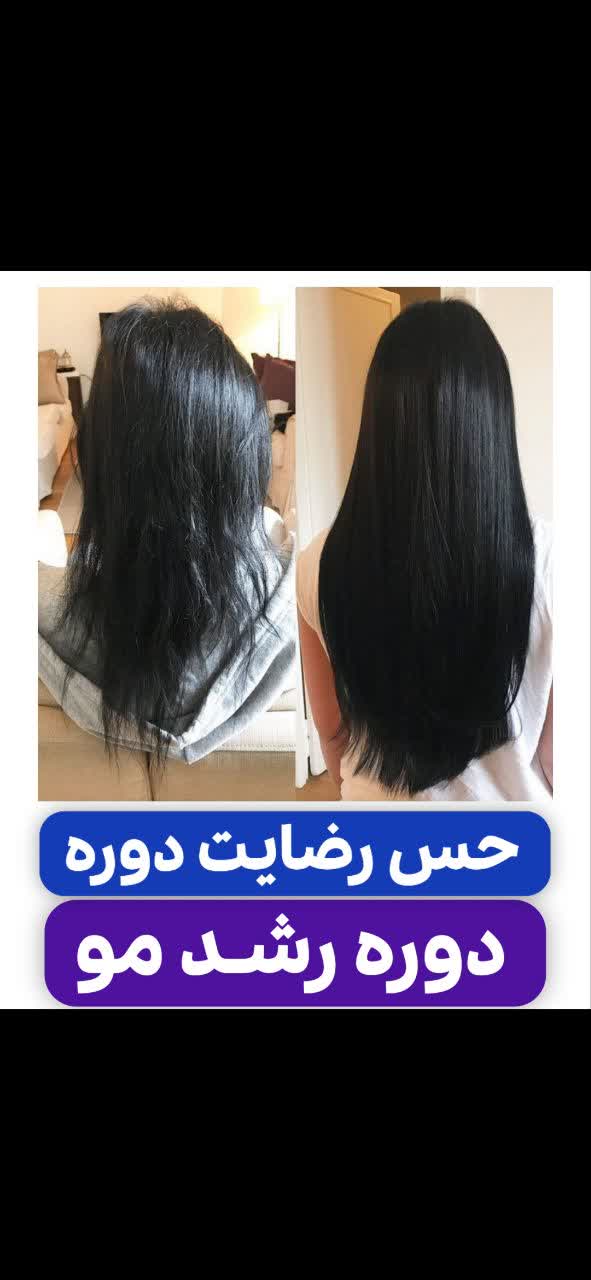 تونیک ضد ریزش و و رویش مجدد مو دوقلو برند اکسونیک-